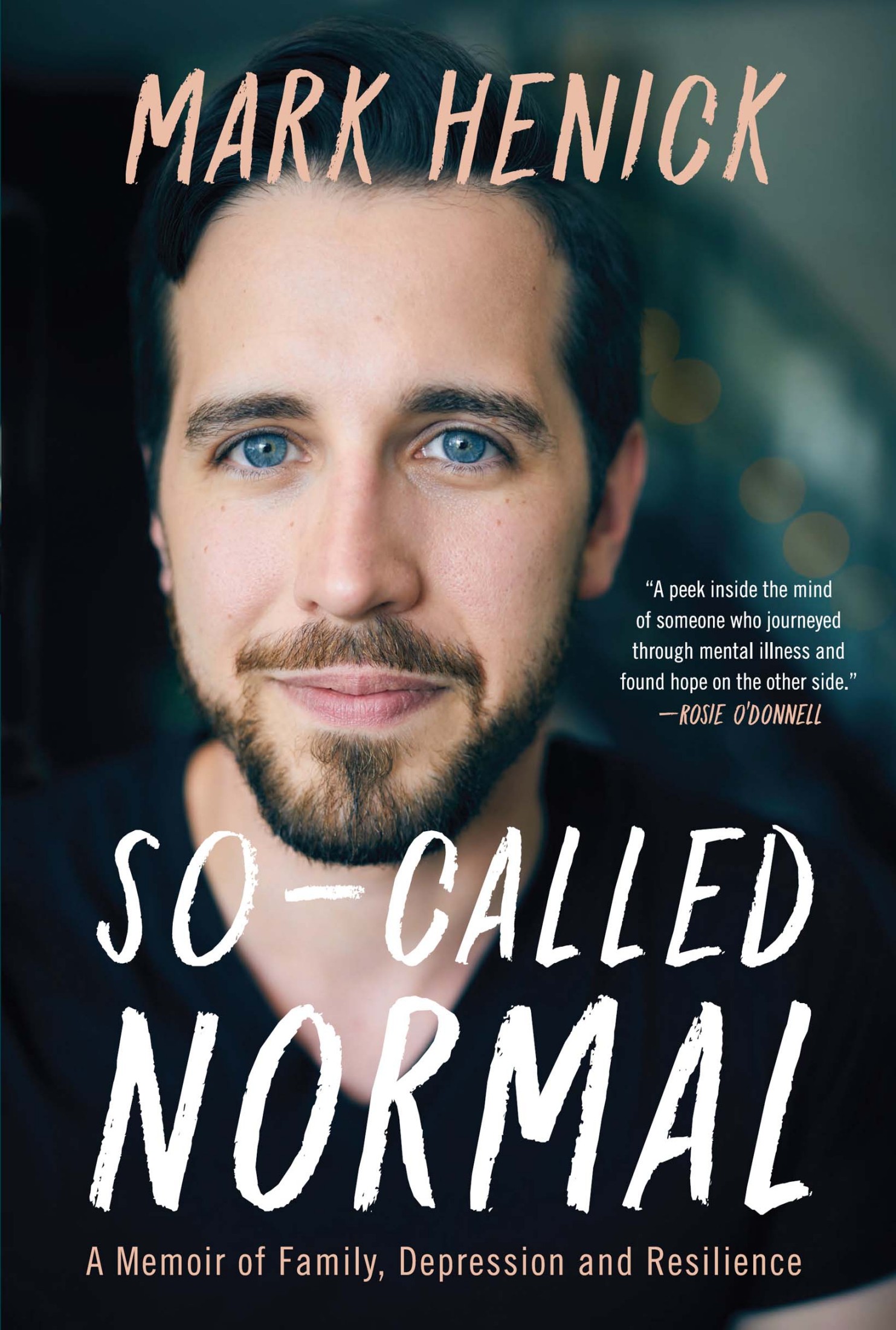 So-Called Normal