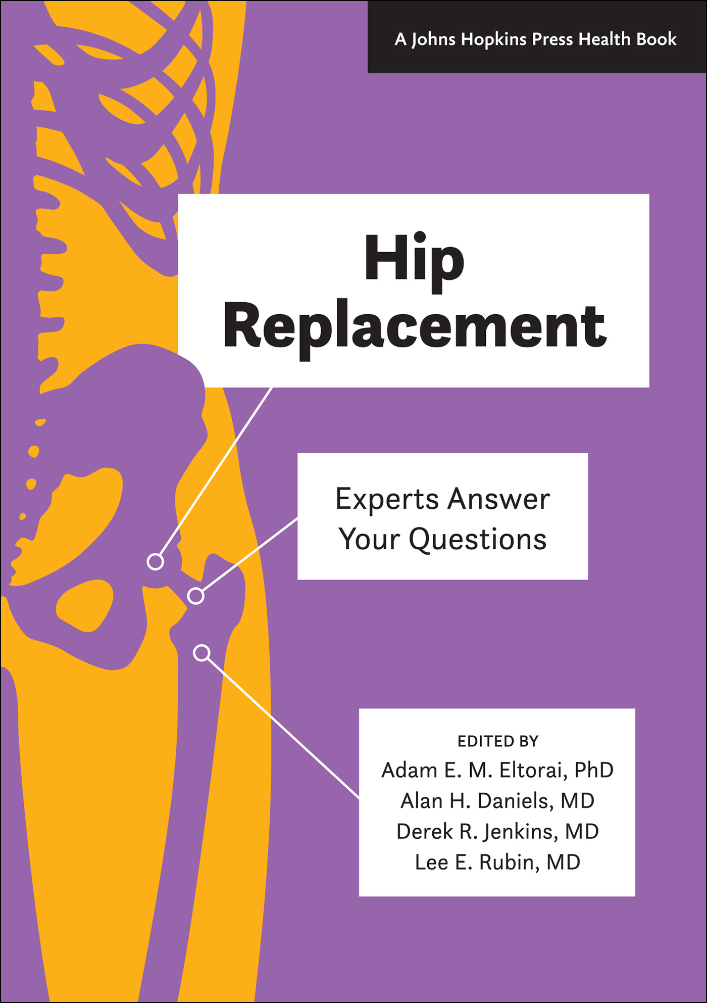 Hip Replacement