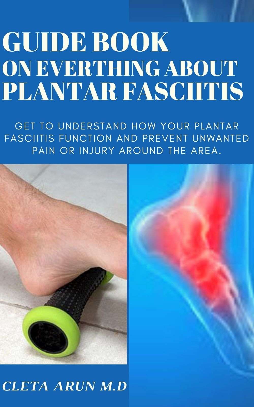 GUIDE BOOK ON EVERYTHING ABOUT PLANTAR FASCIITIS