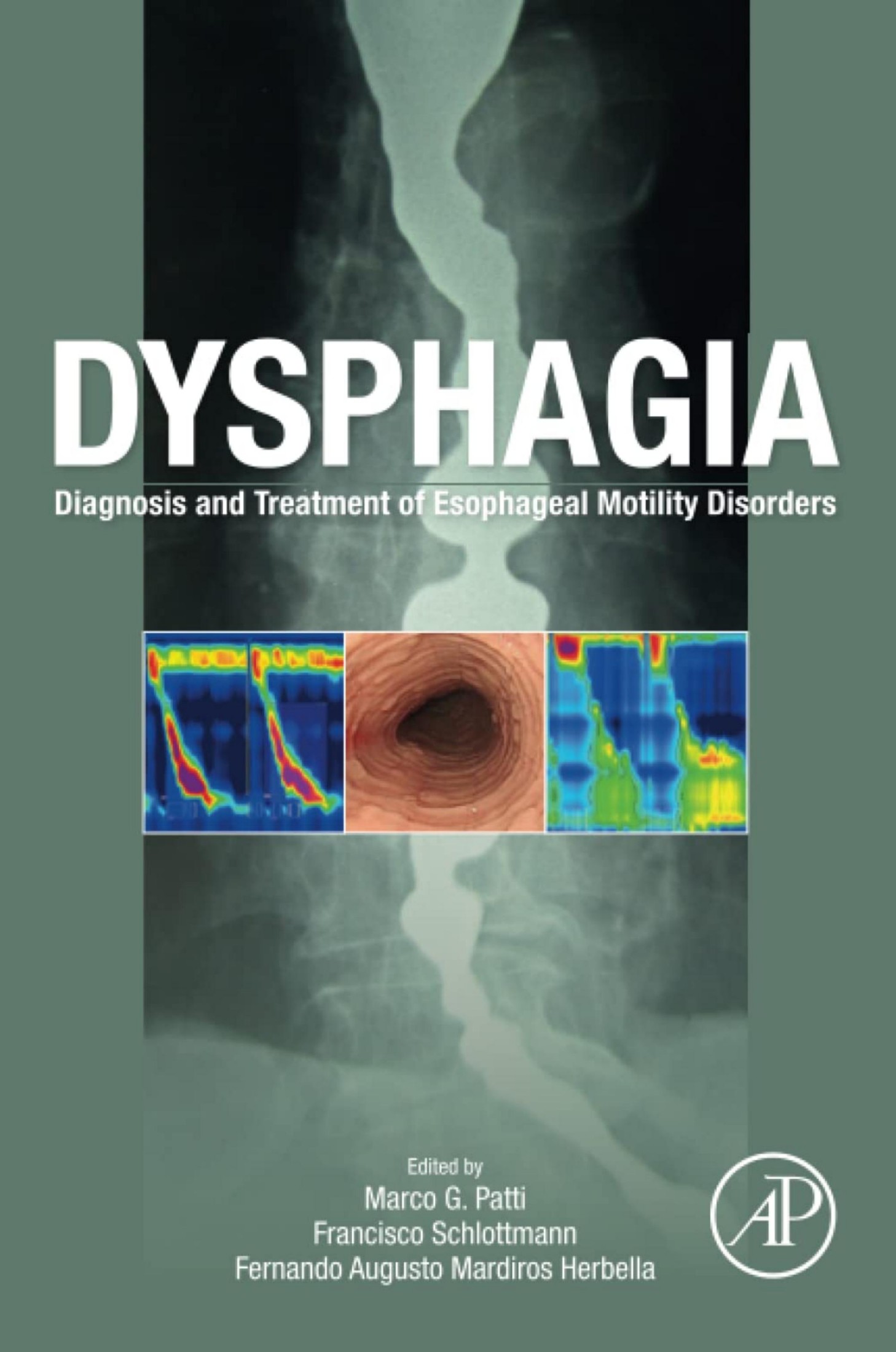 Patti M. Dysphagia.Diagnosis and Treatment of Esophageal Motility Disorders 2023