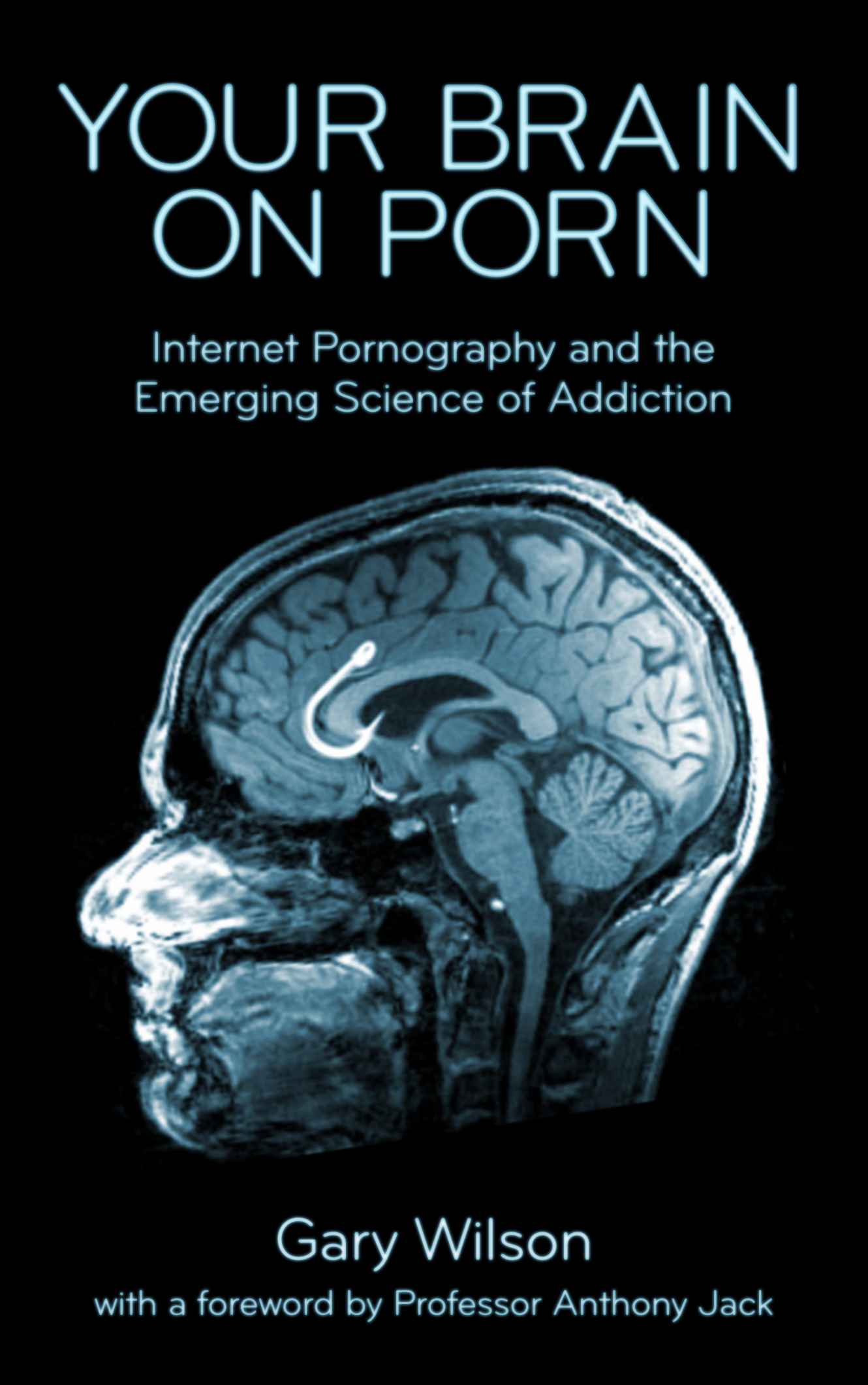 Your Brain on Porn: Internet Pornography and the Emerging Science of Addiction