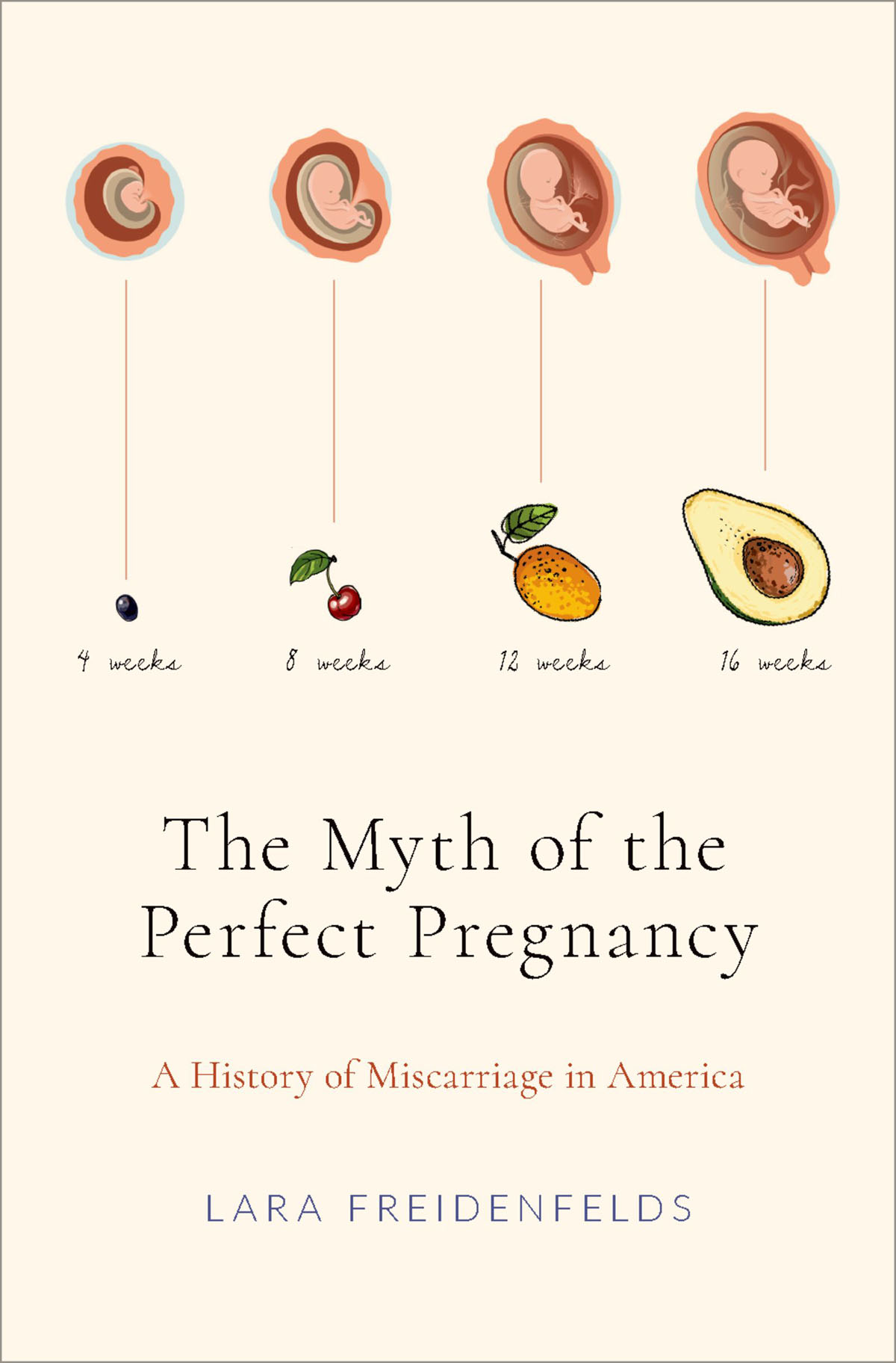 The Myth of the Perfect Pregnancy